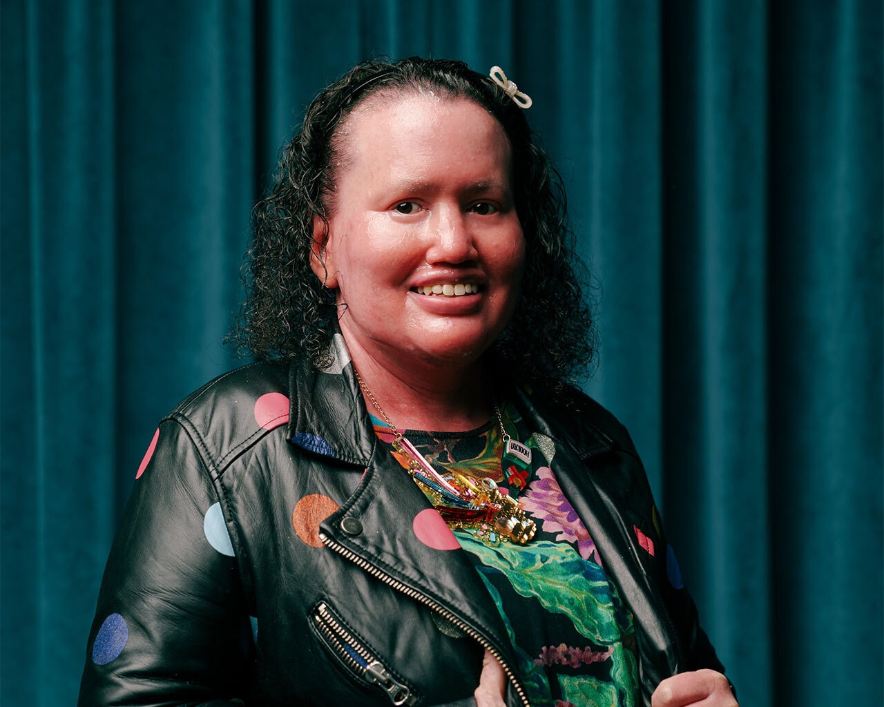 Carly Findlay OAM